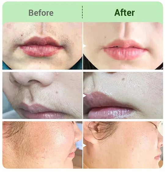 NICOR™ Sada krémů na odstraňování chloupků