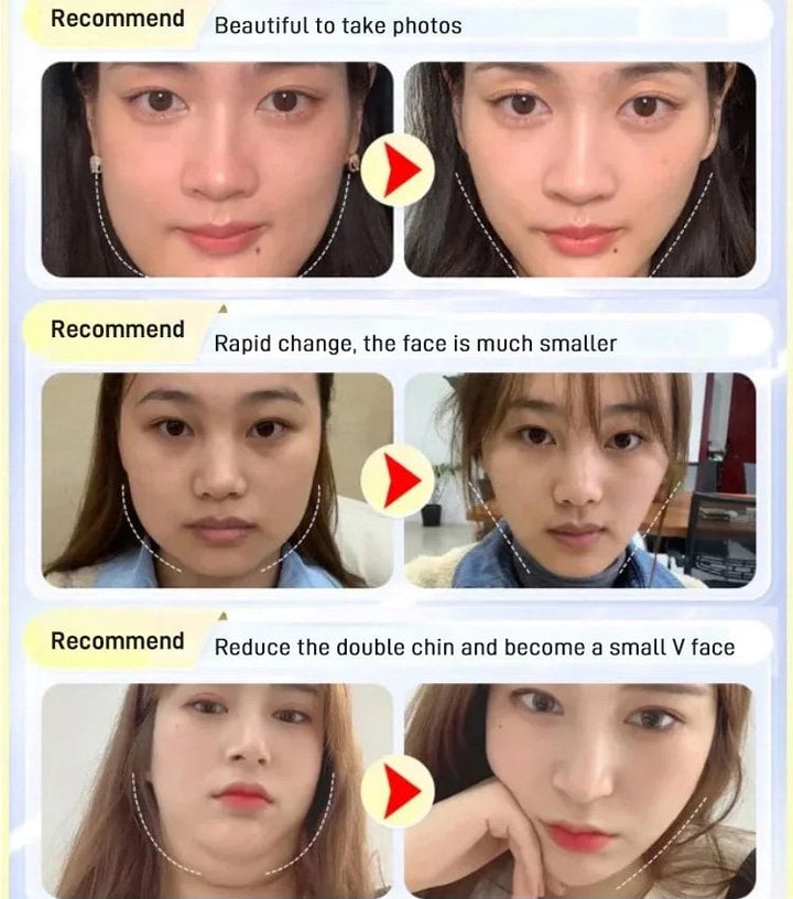 FaceForm™ Zkrášlující maska na spaní