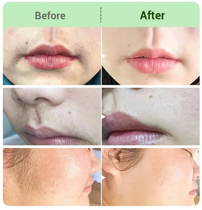 NICOR™ Sada krémů na odstraňování chloupků